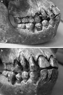 Homo erectus