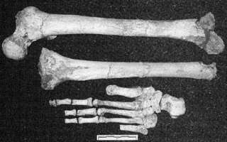 Hobbit leg and foot bones