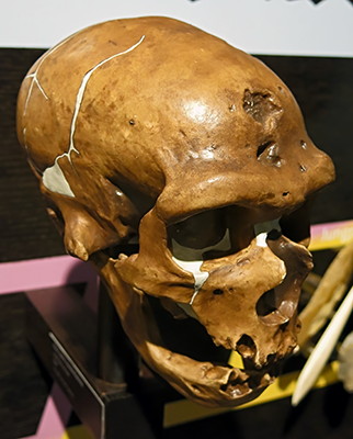  Chapelle skull