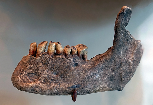 mandible