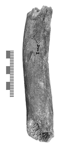 ulna