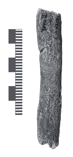 ulna